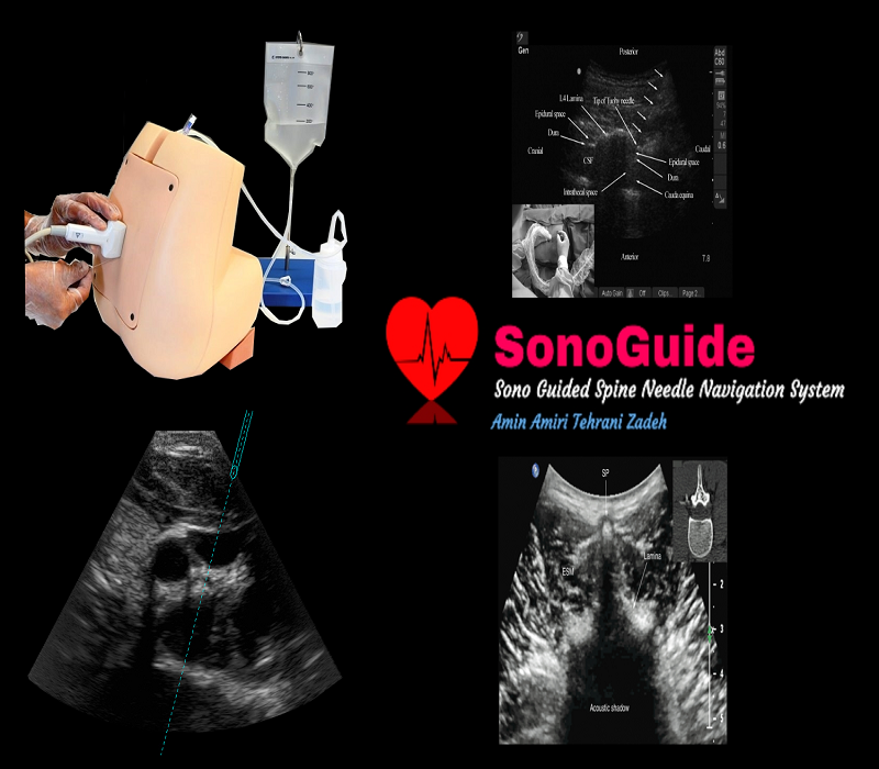 [query-result:title]