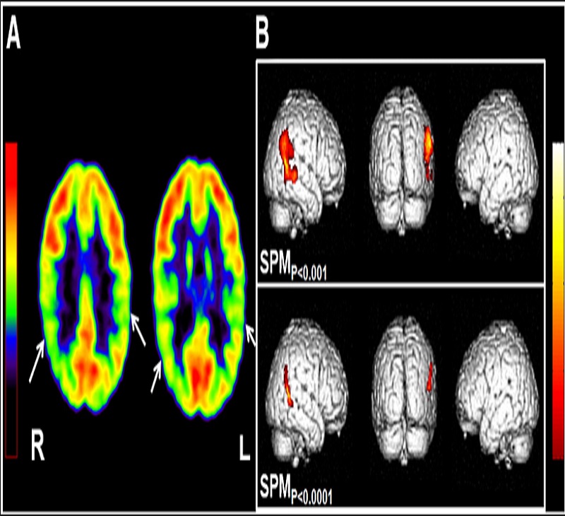 [query-result:title]